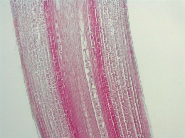Dicot Root LS Slides - Dicot Root LS 03 100X